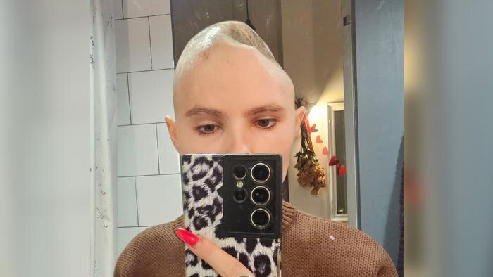 Ира Небога перенесла множество операций. Фото © Telegram / Небога от Бога