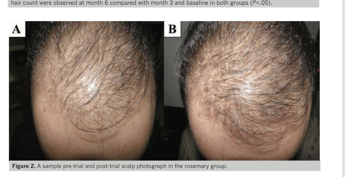 Эффект от использования розмарина 