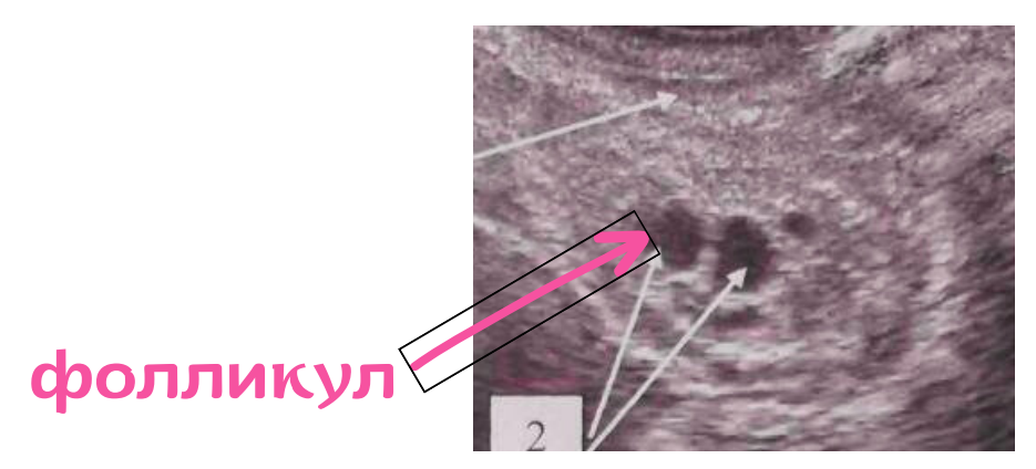 Яичники на УЗИ в 40 лет