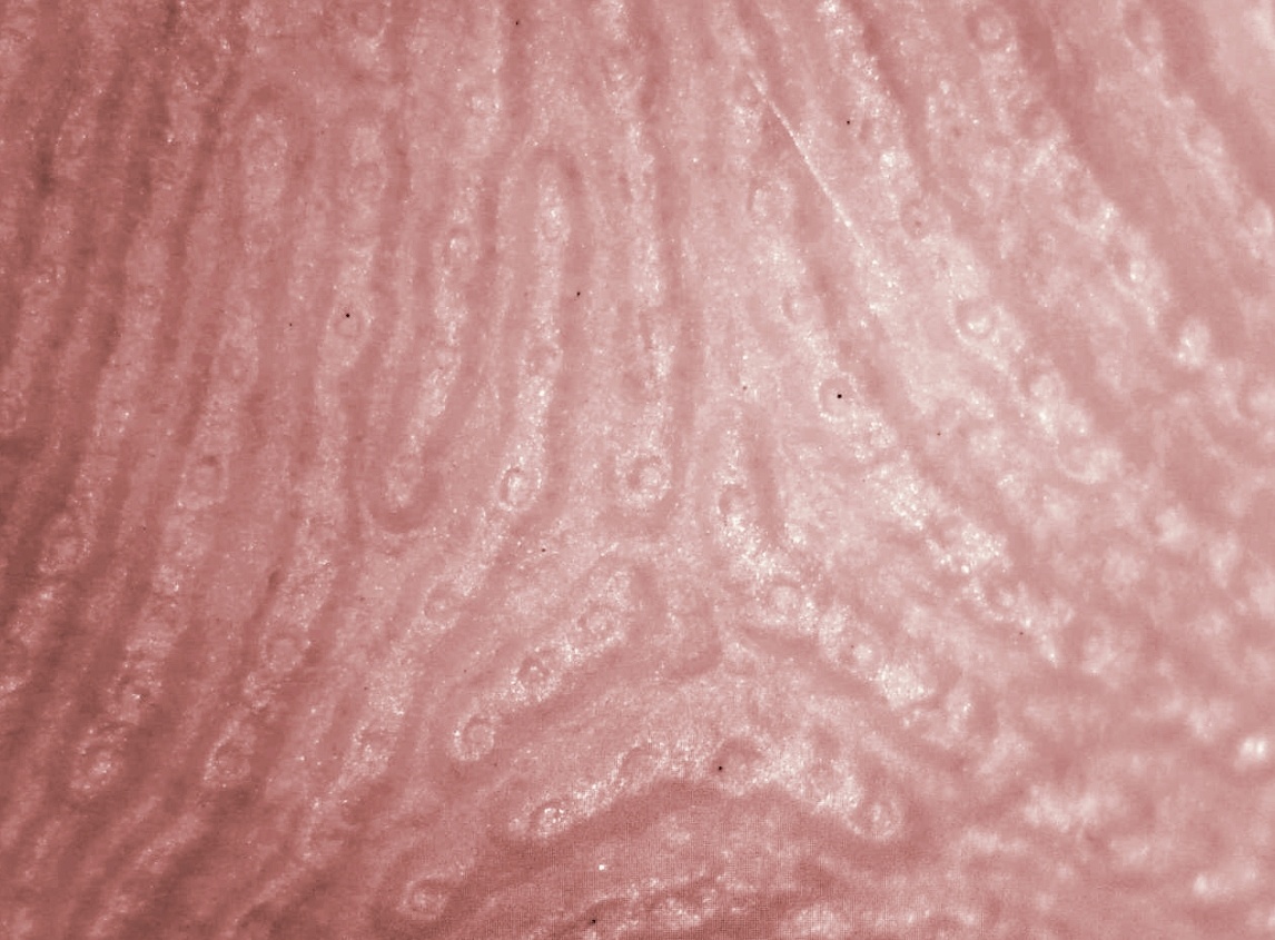    Поры потовых желез на подушечке пальца человека. Источник изображения: wikimedia.org