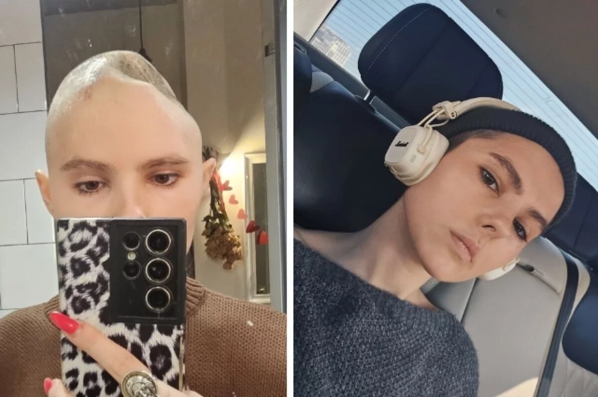    Ирина пережила несколько операций на черепе