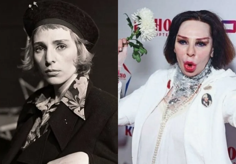 на фото Жанна Агузарова раньше и сейчас