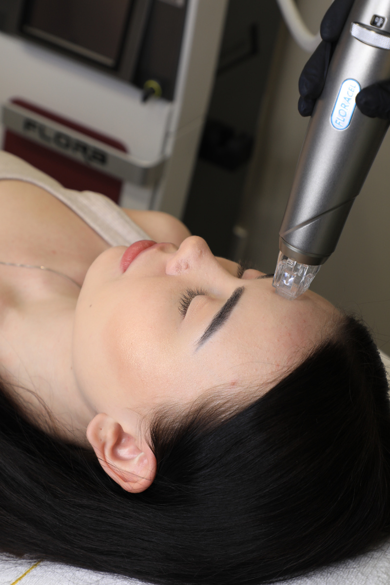 RF-лифтинг в клинике косметологии "DEVIMI"