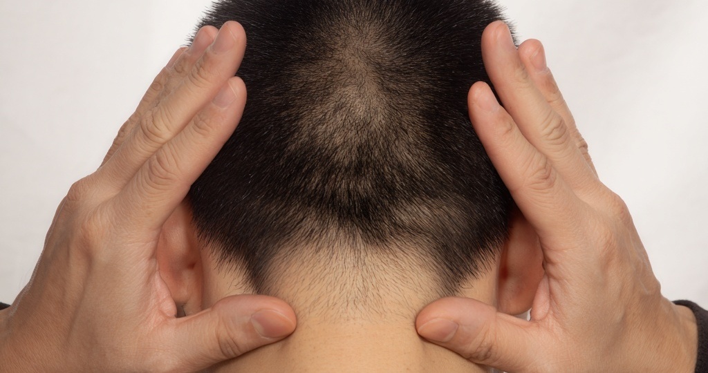 Когда голова «кричит», а тело молчит: почему точка Фэн-чи — ваш секретный выключатель боли