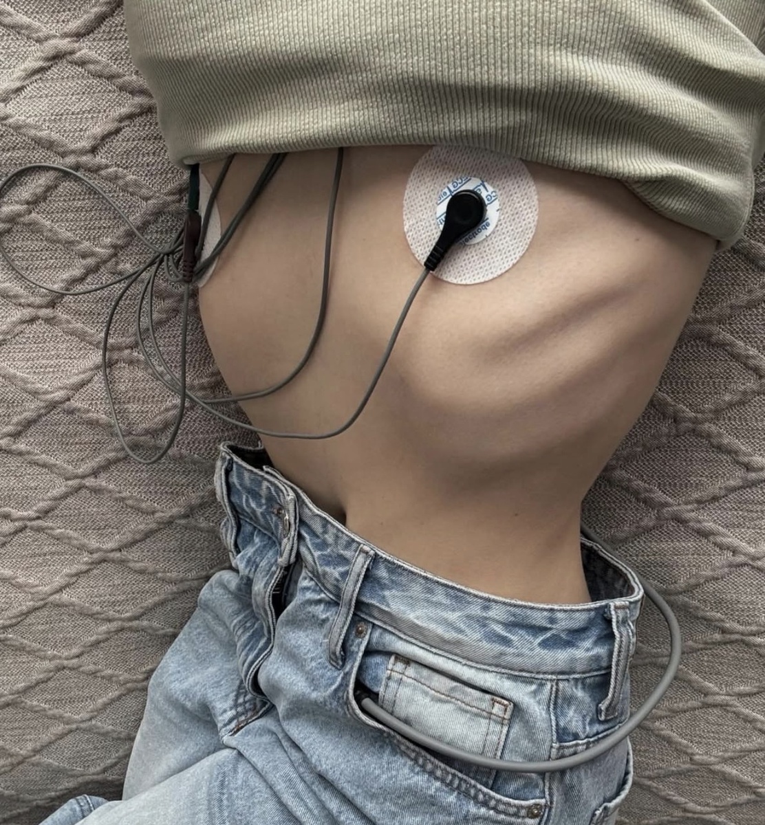 Суточное (Холтеровское) мониторирование ЭКГ