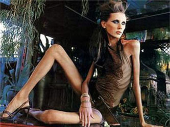 Красивая анорексия  