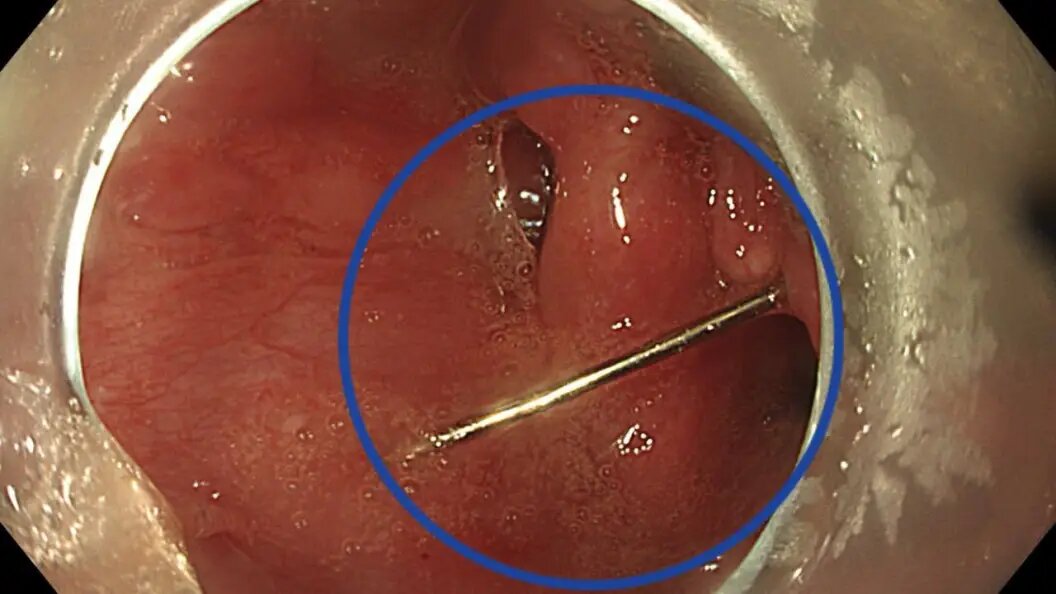    пресс-служба Минздрава Московской области