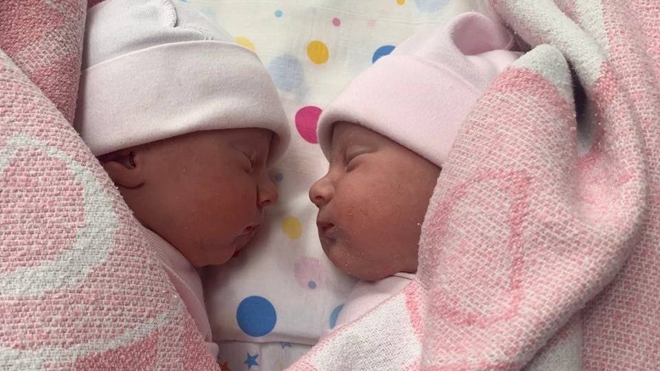Лежали крестиком и переплелись пуповиной 8 раз: В Ростове 42-летняя мама родила редкую двойню, которую врачи назвали чудом
