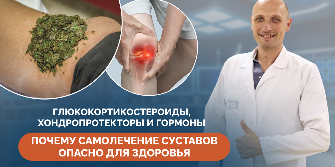 Глюкокортикостероиды, хондропротекторы и гормоны: почему самолечение суставов опасно для здоровья