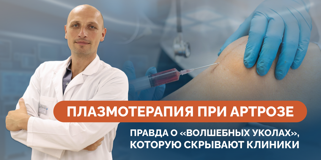 Плазмотерапия при артрозе: правда о «волшебных уколах», которую скрывают клиники