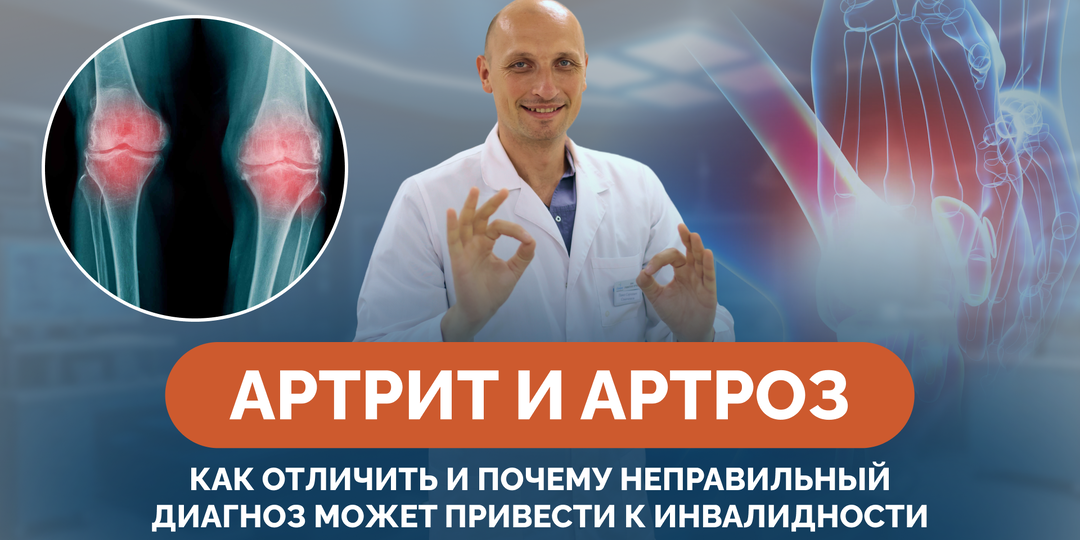 Артрит и артроз: как отличить и почему неправильный диагноз может привести к инвалидности
