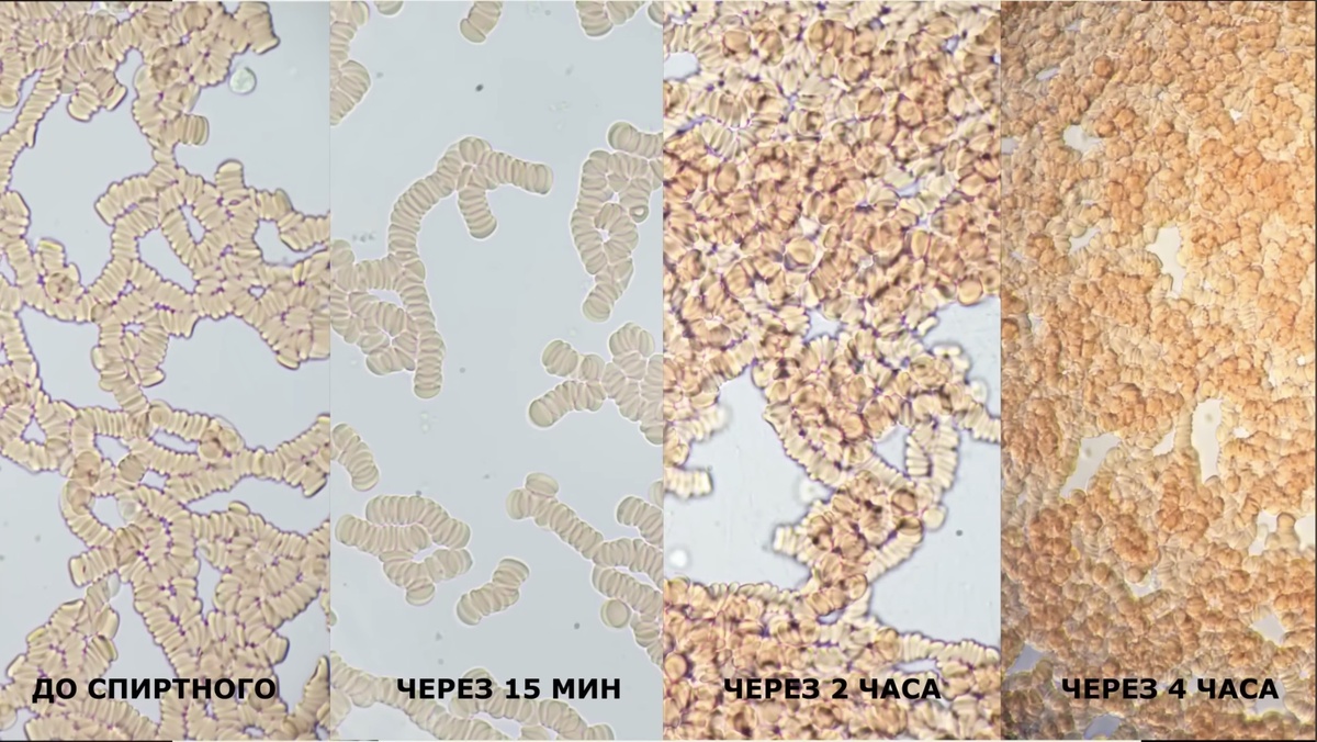 Капиллярная кровь под микроскопом