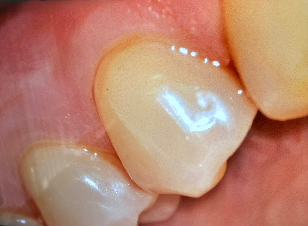 Видите проблему? А она есть