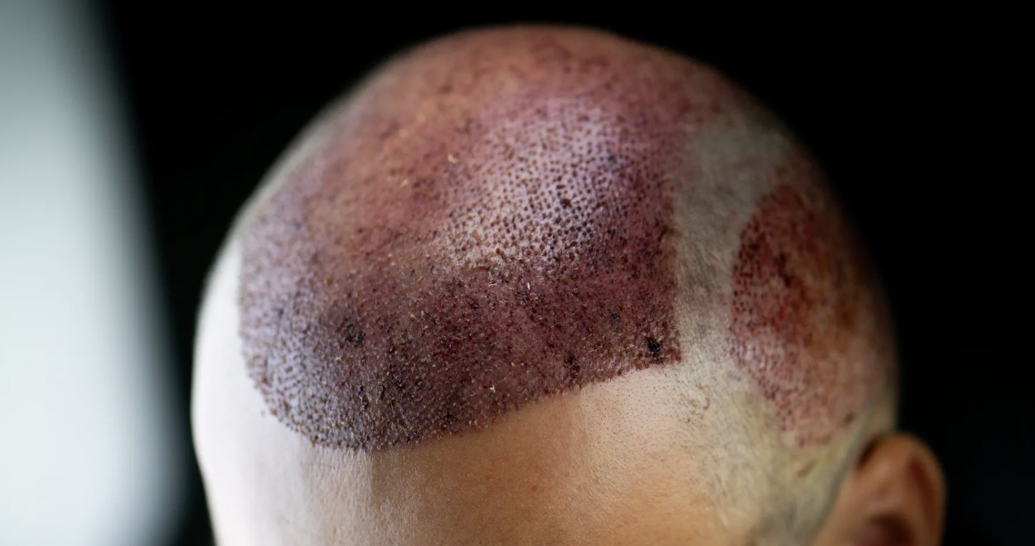 © Getty Images/MASTER