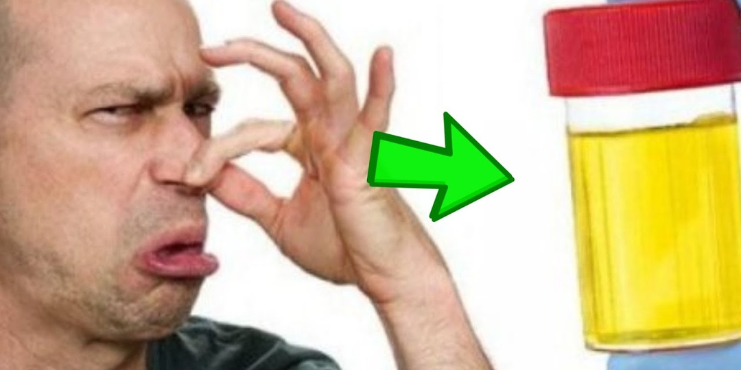 Когда Изменение Запаха Мочи — ранний сигнал опасного заболевания