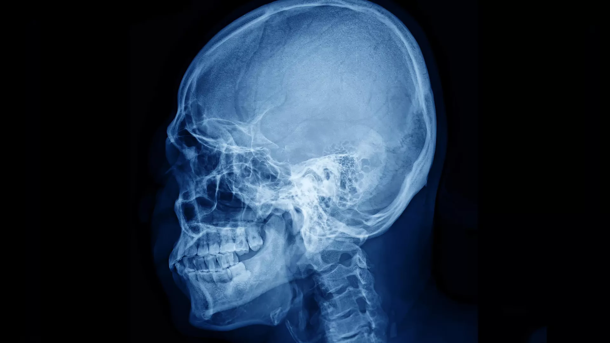 © Getty Images / chuanchai