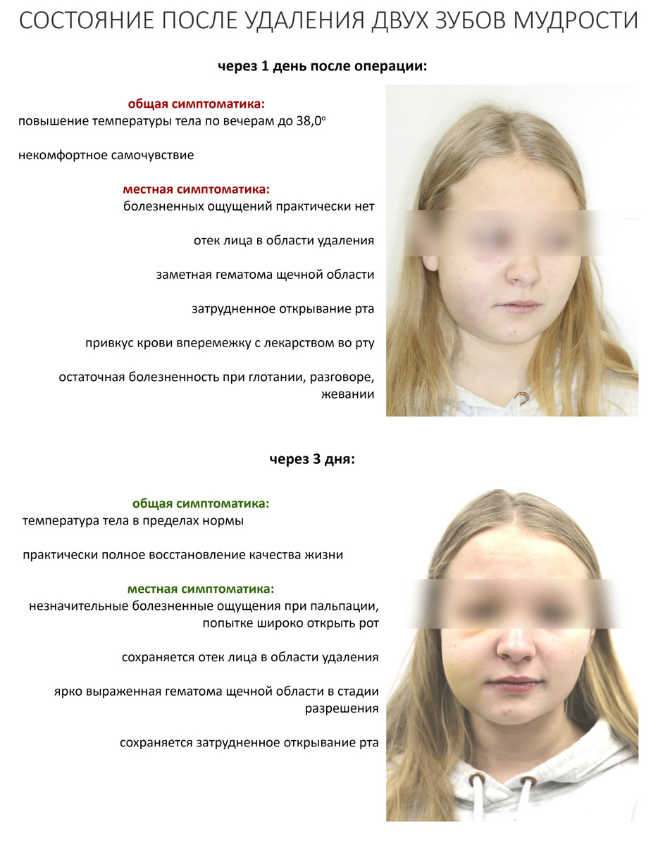 Симптоматика после операции удаления зуба всегда удивляет. Иногда - очень неприятно удивляет.