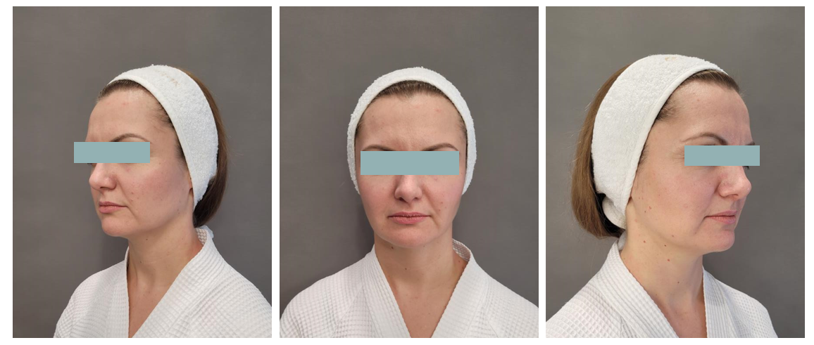 До курса процедур