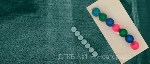    Инородные тела удалось отловить из пищеводно-желудочного прохода ребенка