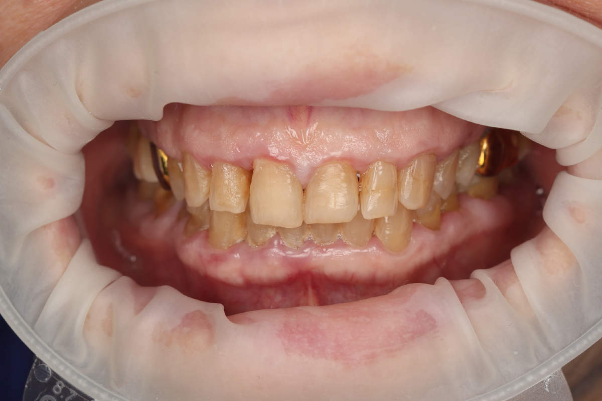 Первый визит и улыбка «ДО»