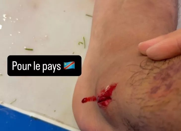    Ногу проткнули, но мечта жива. Видели безумную поездку Бонгонда? Фото #2