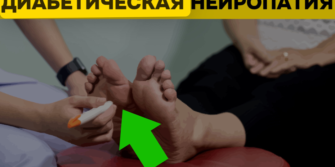 Диабетическая стопа: научный подход к предотвращению осложнений