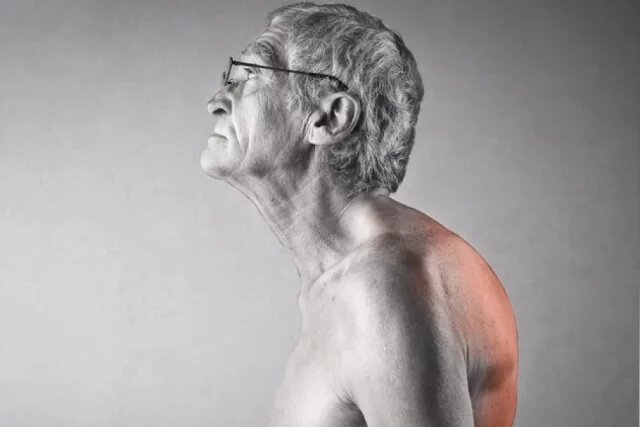    К чему снится горб?