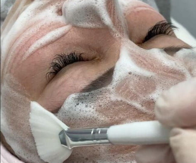 Карбокситерапия, которая “будит” кожу: почему нехватка кислорода делает лицо свежим и сияющим