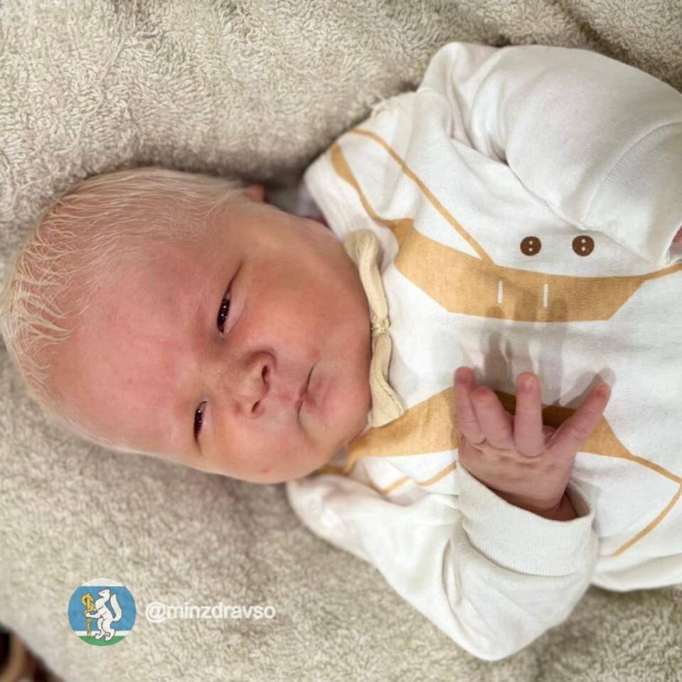 Мальчик-альбинос. Фото: тгк Свет. Екатеринбург 