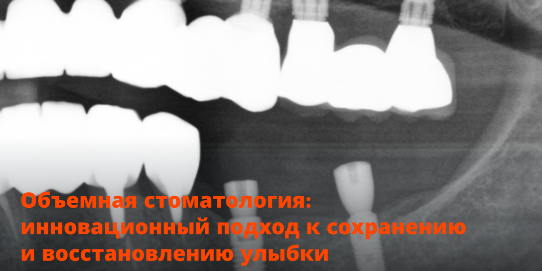 Объемная стоматология: инновационный подход к сохранению и восстановлению улыбки