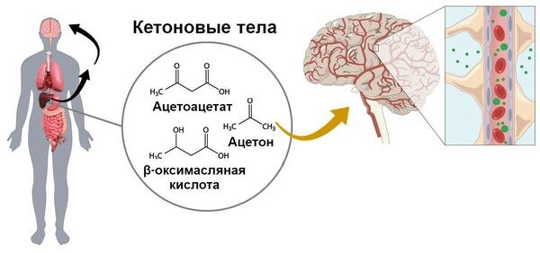 кетоновые тела