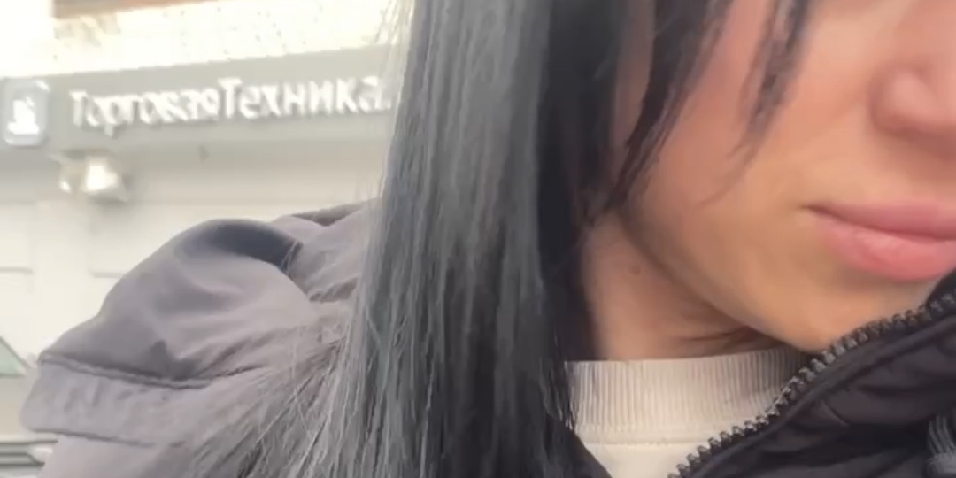 Мнение эндокринологов: метформин и выпадение волос