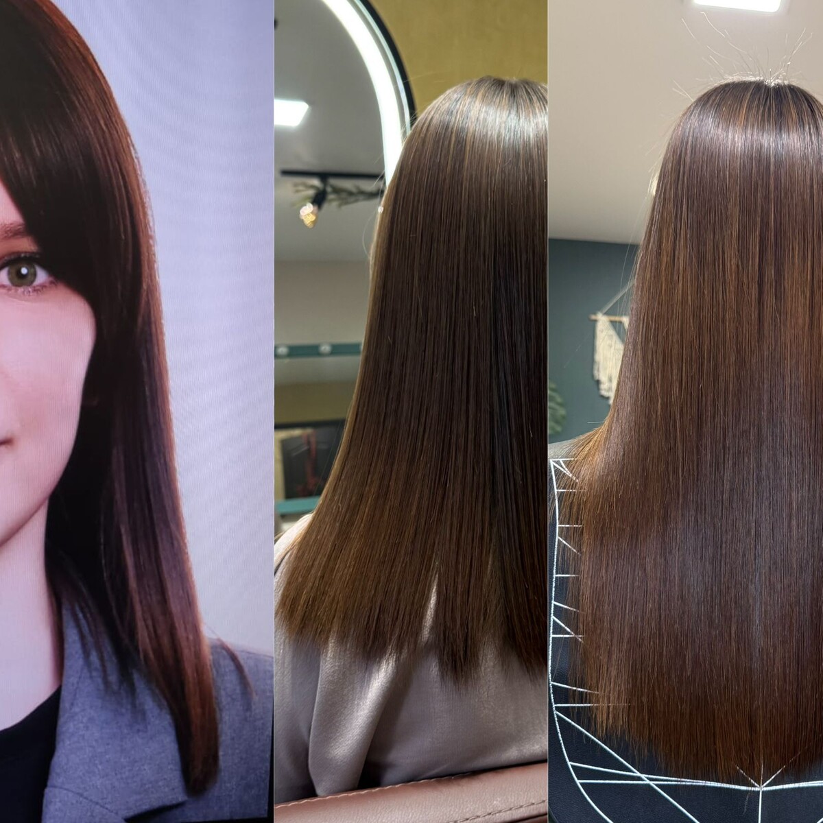 Как растут волосы после нанопластики (результат за 1 год)