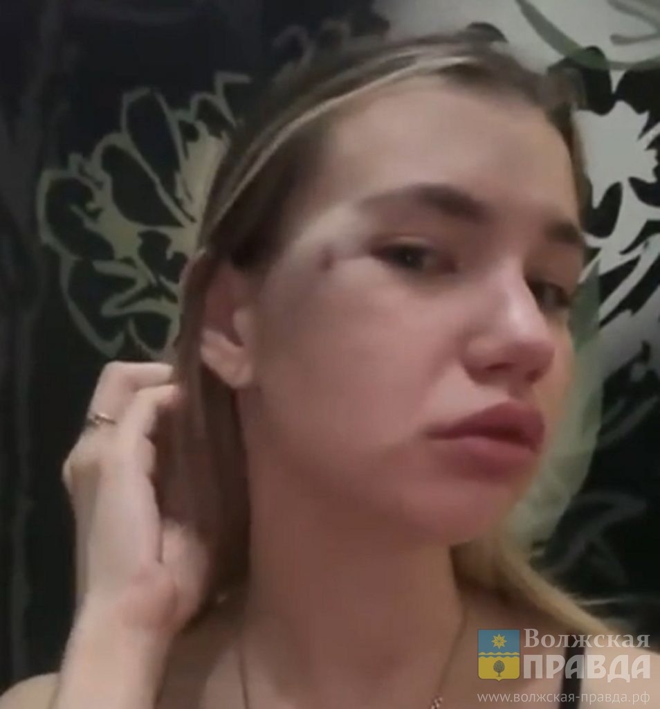 Анна Сытникова. Скриншот с видео V1.RU📷    Головой, кулаком и лбом: обидчик волжанки, не давшей себя «потрогать», заявил, что она била его сама
