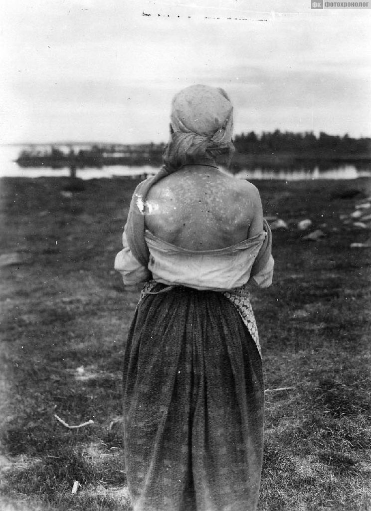 Лопарка. Не знаю, может вот как раз цвет кожи и показывают фотографу в максимально приличном месте, которое можно открыть