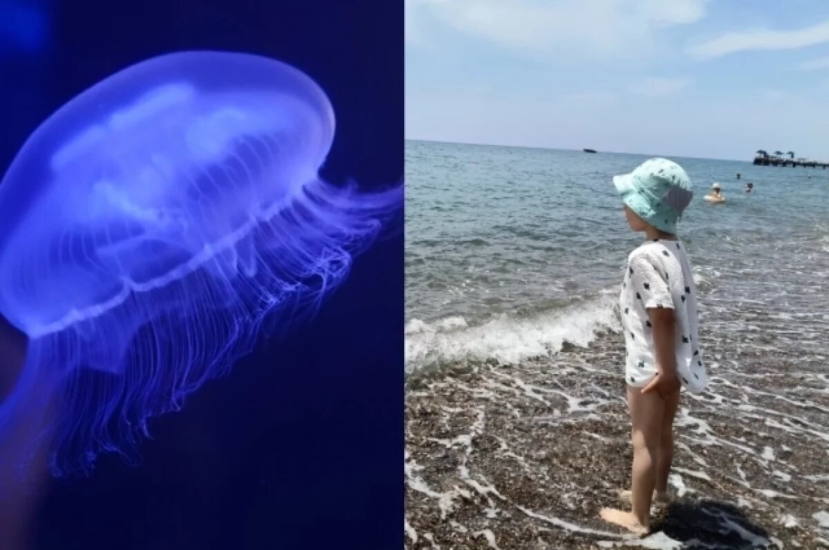    Двухлетнего мальчика укусила кубомедуза