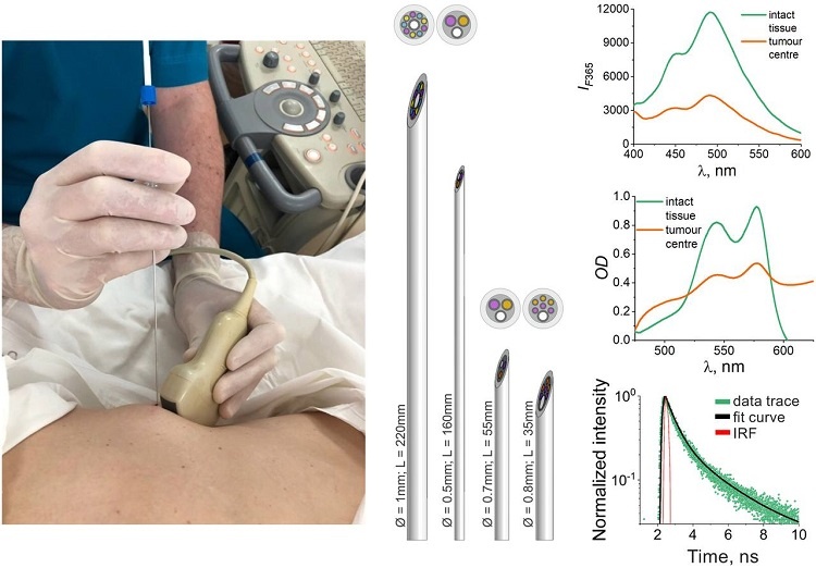 Результаты вышеназванных исследований опубликованы в журнале Light: Advanced Manufacturing (Q1, IF 10.6) в статье «Optical percutaneous needle biopsy in oncology». В статье обобщены существующие решения в области оптической биопсии, направленные на повышение точности диагностики опухолей и навигации при пункционных вмешательствах. Особое внимание уделено использованию мультиспектральных методов — флуоресцентной спектроскопии (ФС), диффузного отражения (СДО) и временно-разрешённой флуоресценции (time-resolved FS). Эти подходы позволяют фиксировать метаболические маркеры (такие как НАДН и ФАД), по содержанию которых можно судить о жизнеспособности и злокачественности тканей.
