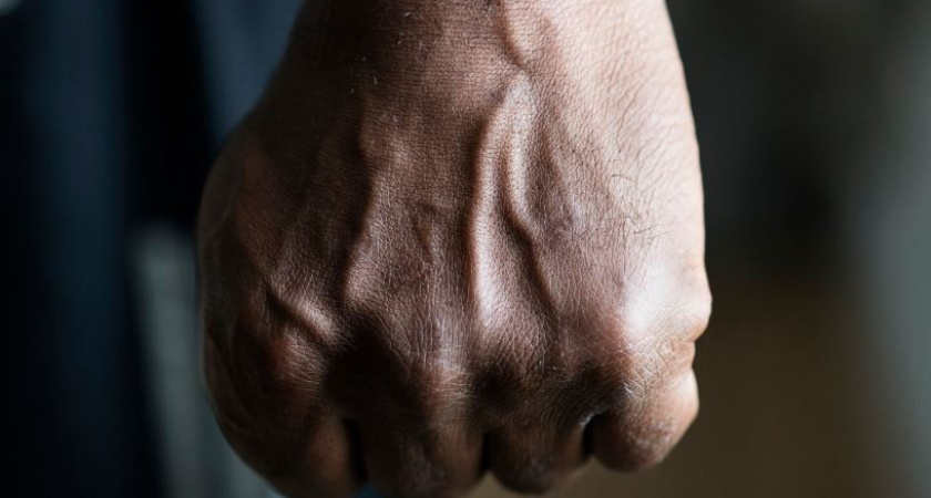    В Калининграде ревнивец избил знакомого до переломов ребер и ушиба легких