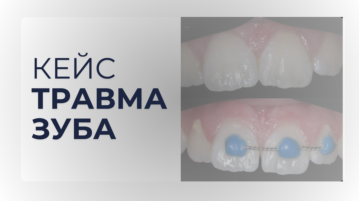 Листайте фото вправо 