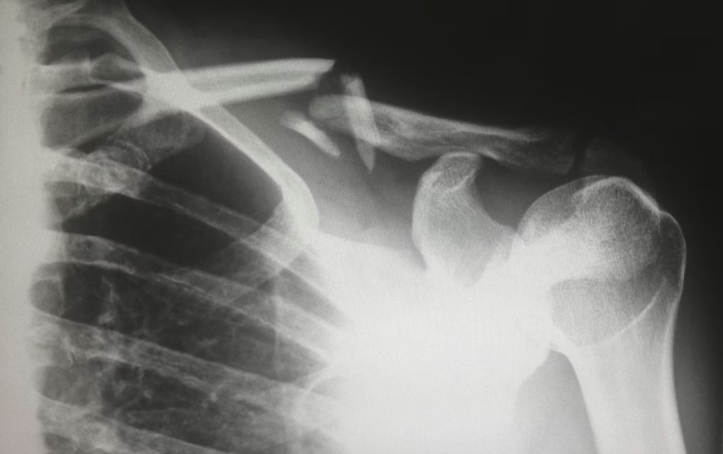 Фото: Harlie Raethel / Unsplash