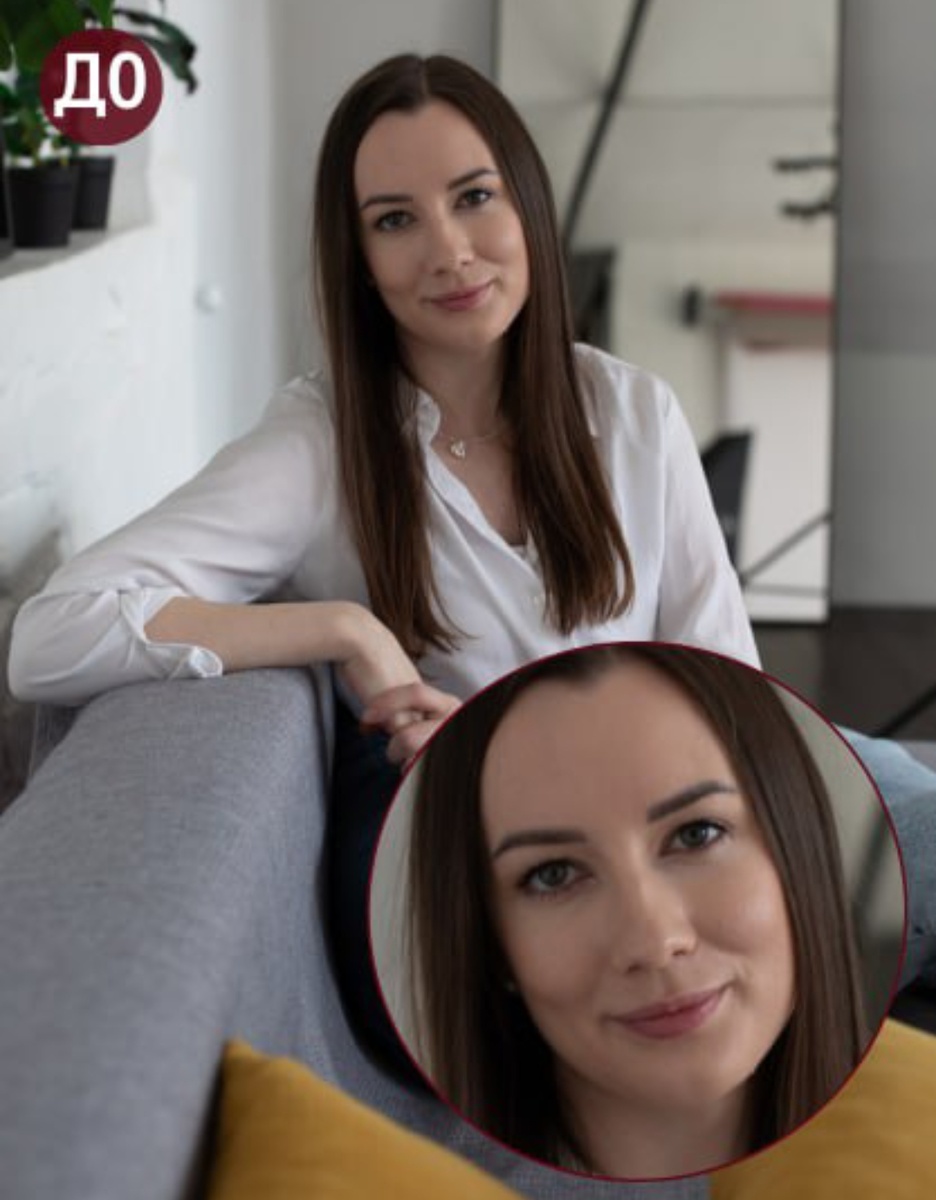 до операции 