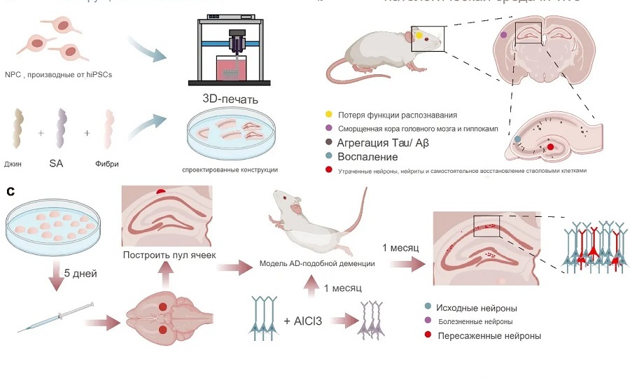 Прийти в себя: 3D-печать против Альцгеймера.