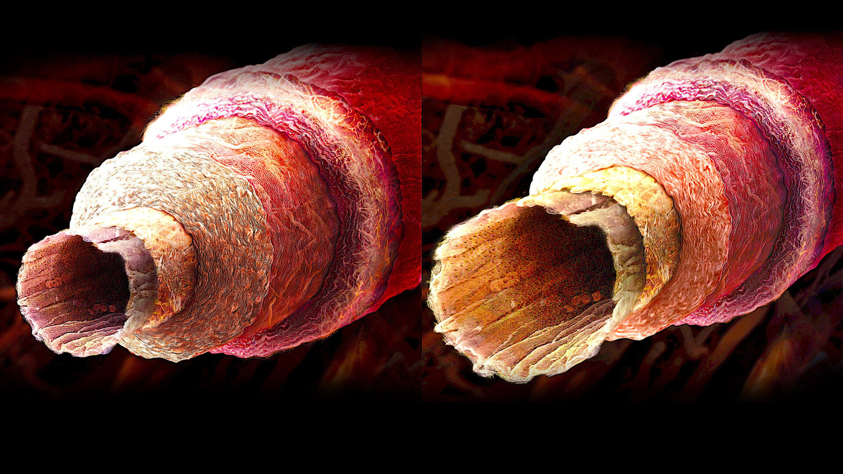 Врач рассказал, как погода влияет на состояние сосудов (интервью)