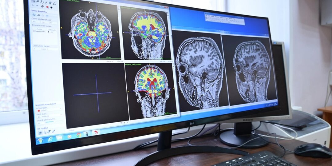 ТГУ разрабатывает "атлас" мозга для диагностики последствий COVID-19