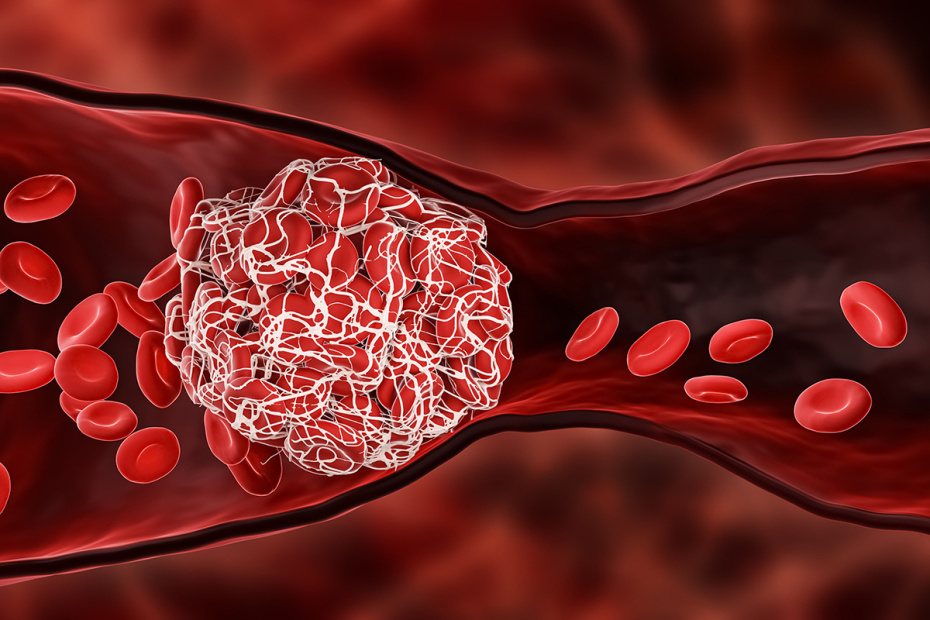    Shutterstock/FOTODOM