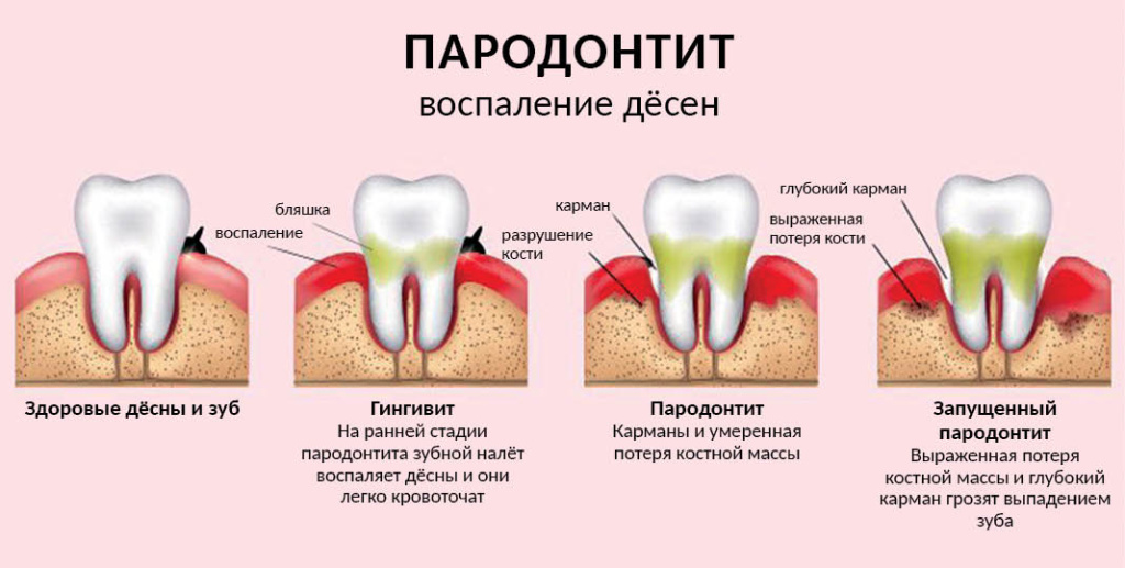 Фото: izhstom.com