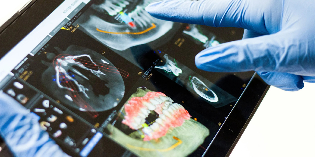 А вы готовы к протезированию? Почему без десен и кости — никуда 🤔