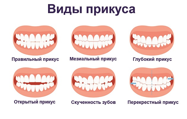 *изображение из статьи: https://servantesmsk.ru/statyi/tpost/pjipojepr1-kogda-luchshe-privesti-rebyonka-k-ortodo 