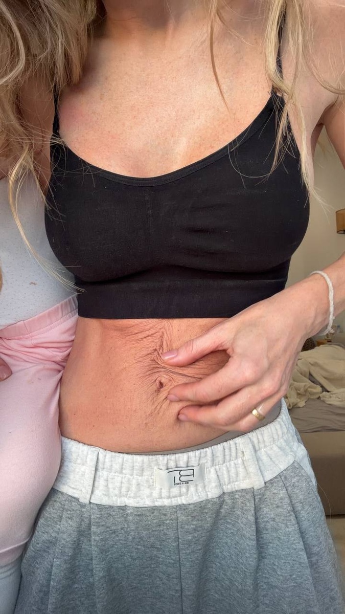    Анна Хилькевич показала тело после третьих родовСоцсети Анны Хилькевич