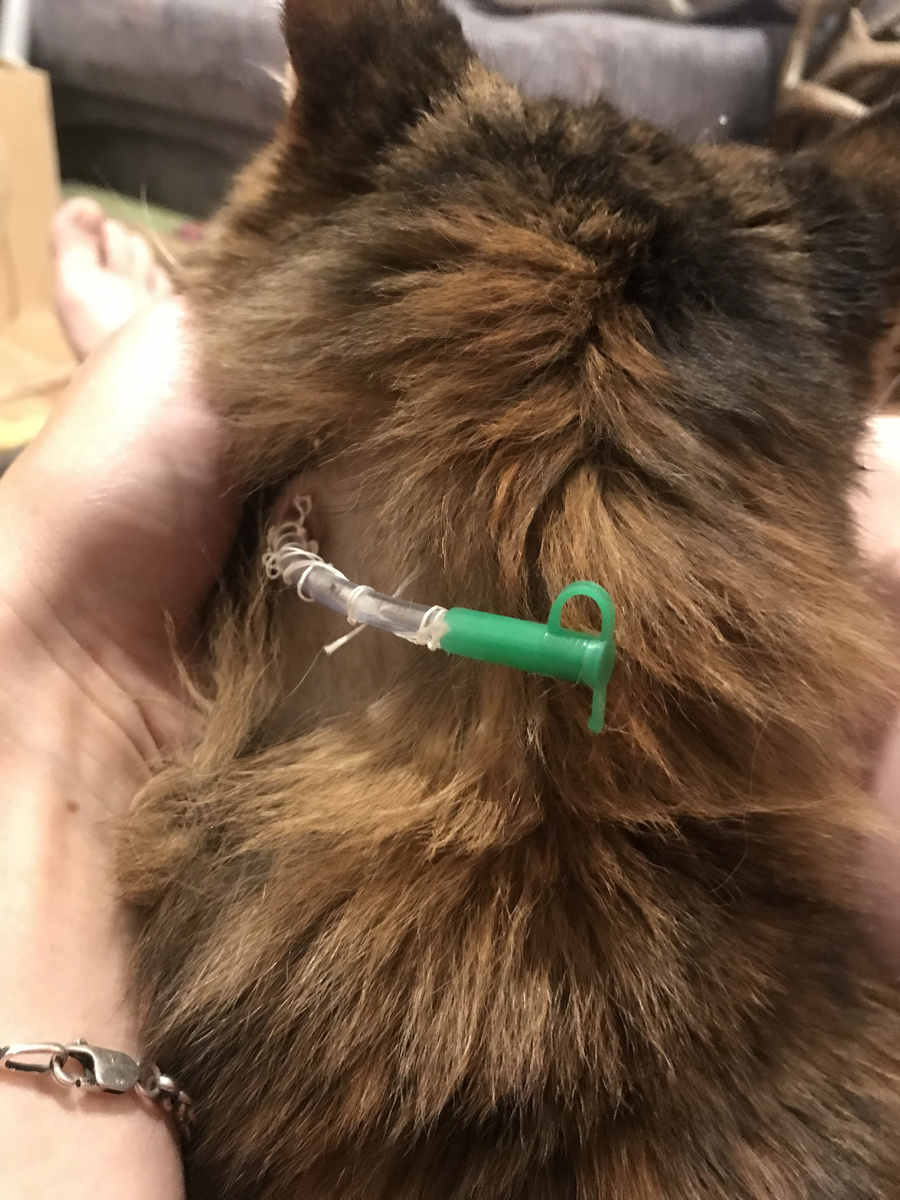 Эзофагостома